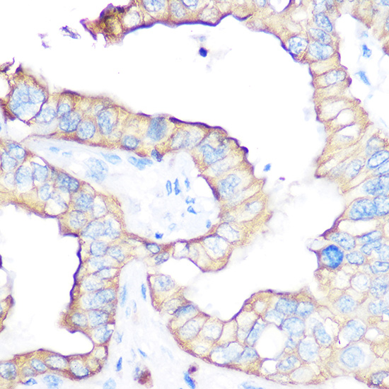 CD47 Rabbit Polyclonal Antibody