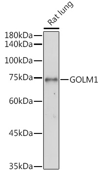 GOLM1 Rabbit Polyclonal Antibody