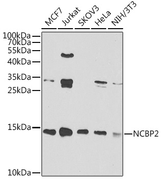 NCBP2 Rabbit Polyclonal Antibody