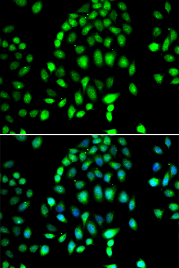 PARP3 Rabbit Polyclonal Antibody