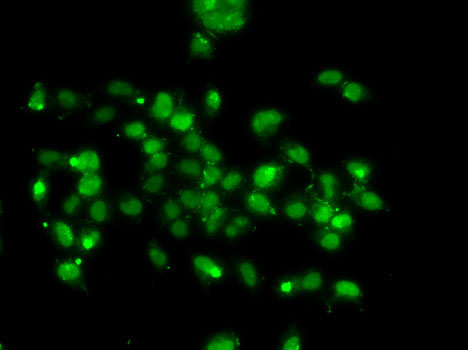 WBSCR22 Rabbit Polyclonal Antibody