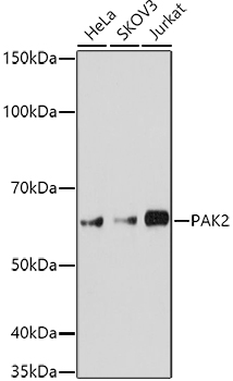 PAK2 Rabbit Polyclonal Antibody