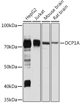DCP1A Rabbit Polyclonal Antibody