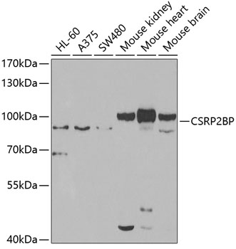 CSRP2BP Rabbit Polyclonal Antibody