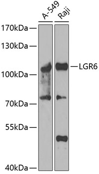 LGR6 Rabbit Polyclonal Antibody