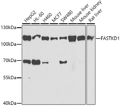 FASTKD1 Rabbit Polyclonal Antibody