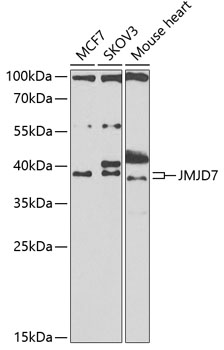 JMJD7 Rabbit Polyclonal Antibody