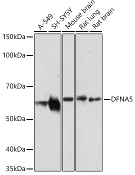 DFNA5/GSDME Rabbit Polyclonal Antibody