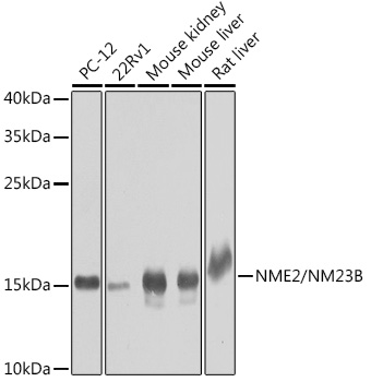 NME2 Rabbit Polyclonal Antibody