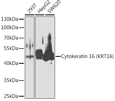 KRT16 Rabbit Polyclonal Antibody