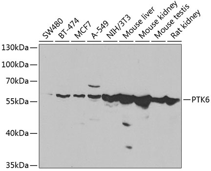 PTK6 Rabbit Polyclonal Antibody