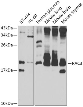 RAC3 Rabbit Polyclonal Antibody