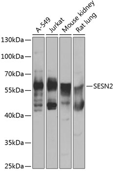 SESN2 Rabbit Polyclonal Antibody