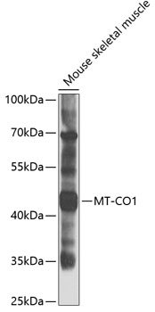 COX1 Rabbit Polyclonal Antibody