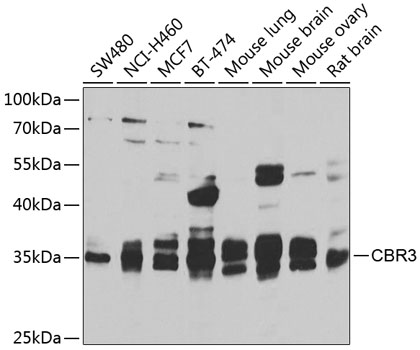 CBR3 Rabbit Polyclonal Antibody