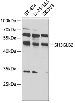 SH3GLB2 Rabbit Polyclonal Antibody