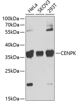 CENPK Rabbit Polyclonal Antibody