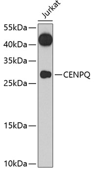 CENPQ Rabbit Polyclonal Antibody
