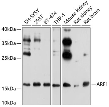 ARF1 Rabbit Polyclonal Antibody