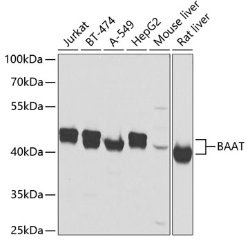 BAAT Rabbit Polyclonal Antibody