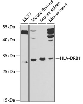HLA-DRB1 Rabbit Polyclonal Antibody