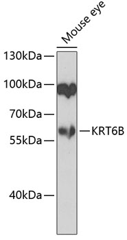 KRT6B Rabbit Polyclonal Antibody