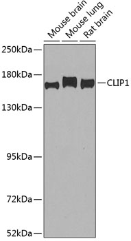 CLIP1 Rabbit Polyclonal Antibody