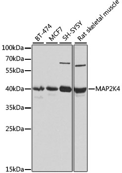 MAP2K4 Rabbit Polyclonal Antibody