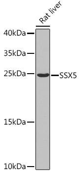 SSX5 Rabbit Polyclonal Antibody