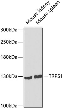 TRPS1 Rabbit Polyclonal Antibody