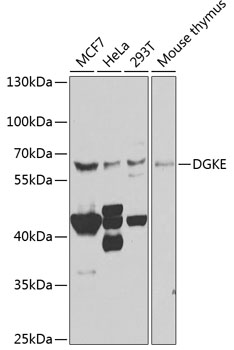 DGKE Rabbit Polyclonal Antibody