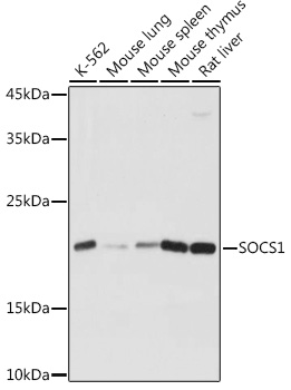 SOCS1 Rabbit Polyclonal Antibody