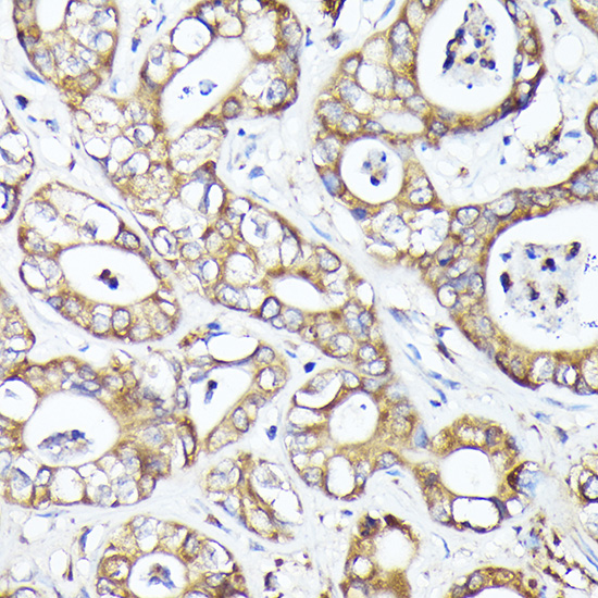 MTMR4 Rabbit Polyclonal Antibody