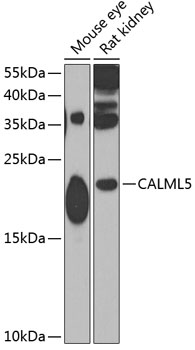 CALML5 Rabbit Polyclonal Antibody