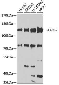 AARS2 Rabbit Polyclonal Antibody