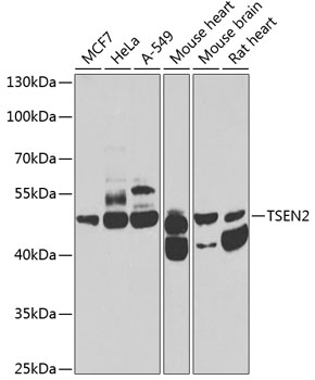 TSEN2 Rabbit Polyclonal Antibody