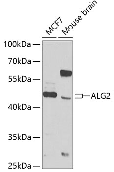 ALG2 Rabbit Polyclonal Antibody
