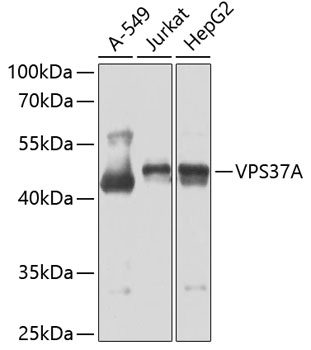 VPS37A Rabbit Polyclonal Antibody