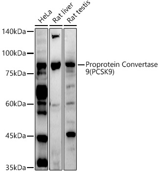 PCSK9 Rabbit Polyclonal Antibody