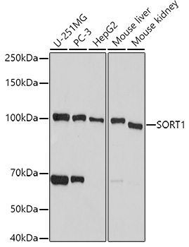 SORT1 Rabbit Polyclonal Antibody