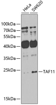 TAF11 Rabbit Polyclonal Antibody