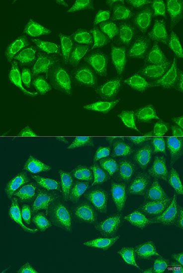 TFE3 Rabbit Polyclonal Antibody
