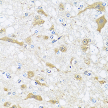 APOL1 Rabbit Polyclonal Antibody