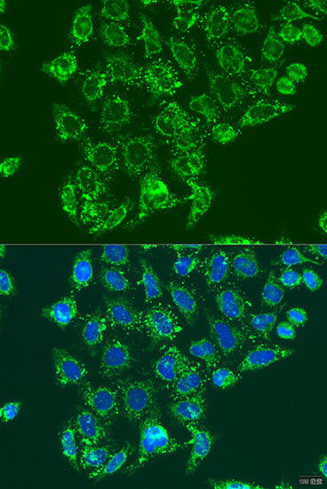 TMC6 Rabbit Polyclonal Antibody
