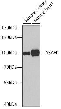 ASAH2 Rabbit Polyclonal Antibody