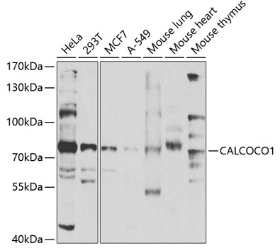 CALCOCO1 Rabbit Polyclonal Antibody