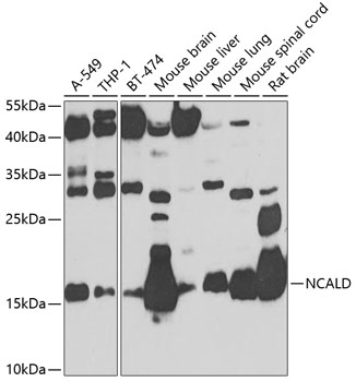 NCALD Rabbit Polyclonal Antibody