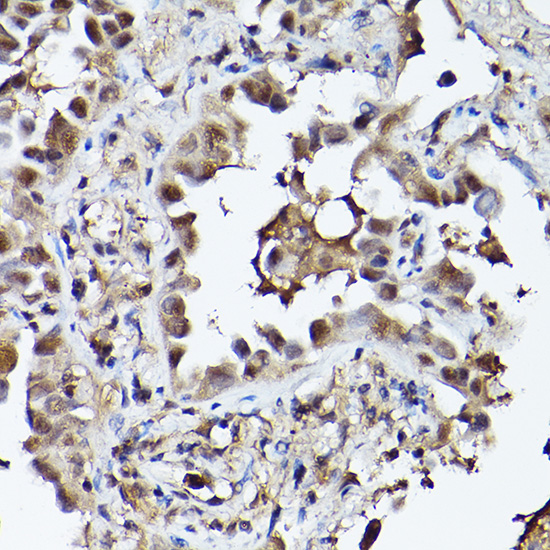 EGLN3 Rabbit Polyclonal Antibody