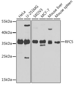 RFC5 Rabbit Polyclonal Antibody