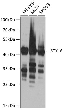 STX16 Rabbit Polyclonal Antibody